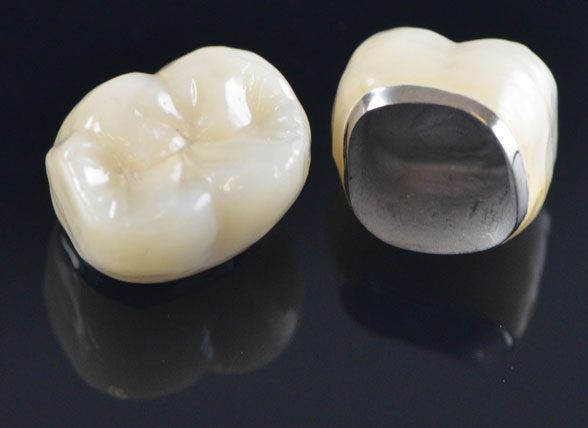 Dental crown