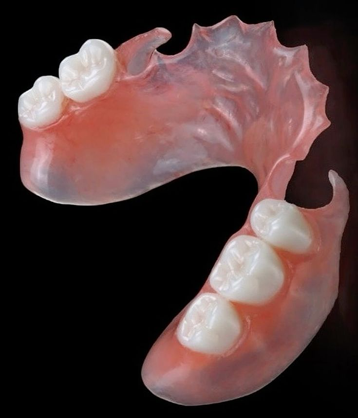Partial denture